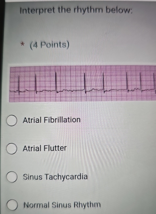 Solved: Interpret the rhythm below: * (4 Points) Atrial Fibrillation ...