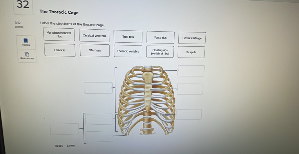 Solved: The Thoracic Cage 3.12 Label the structures of the thoracic ...