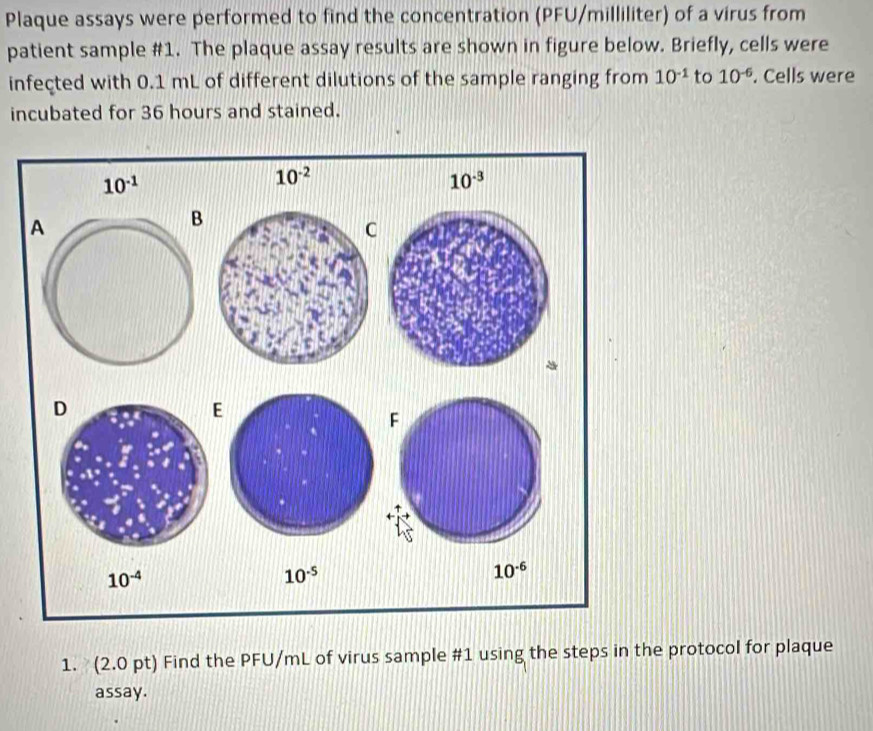 Plaque assays were performed to find the concentration (PFU/milliliter) of a virus from 
patient sample #1. The plaque assay results are shown in figure below. Briefly, cells were 
infected with 0.1 mL of different dilutions of the sample ranging from 10^(-1) to 10^(-6). Cells were 
incubated for 36 hours and stained.
10^(-1)
10^(-2)
10^(-3)
10^(-4)
10^(-5)
10^(-6)
1. (2.0 pt) Find the PFU/mL of virus sample #1 using the steps in the protocol for plaque 
assay.