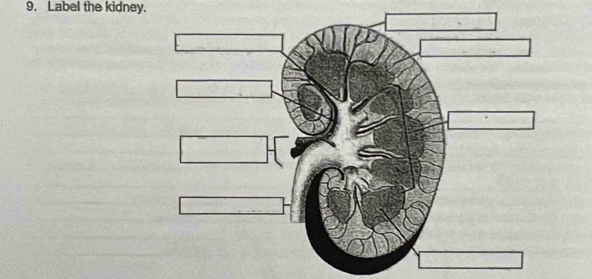 Label the kidney.