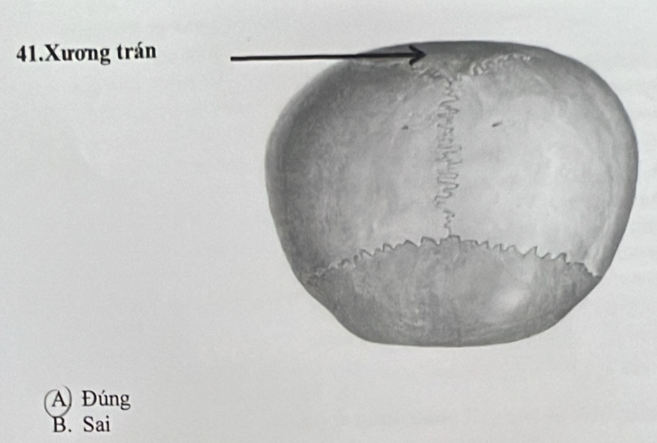 Xương trán
A Đúng
B. Sai