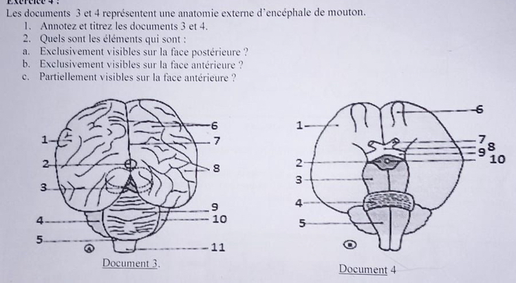 Exéréfce 4 : 
Les documents 3 et 4 représentent une anatomie externe d'encéphale de mouton. 
1. Annotez et titrez les documents 3 et 4. 
2. Quels sont les éléments qui sont : 
a. Exclusivement visibles sur la face postérieure ? 
b. Exclusivement visibles sur la face antérieure ? 
c. Partiellement visibles sur la face antérieure ?