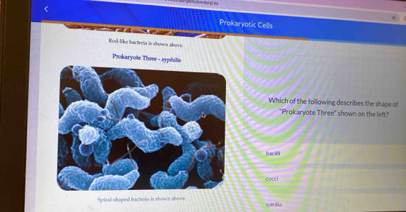 A ga murd senbmj E4A
Prokaryotic Cells
Rod-like bacteria is shown above.
Prokaryote Three - syphilis
Which of the following describes the shape of
"Prokaryote Three" shown on the left?
bacilli
cocci
Spiral-shaped bactera is shown above.
spirilia