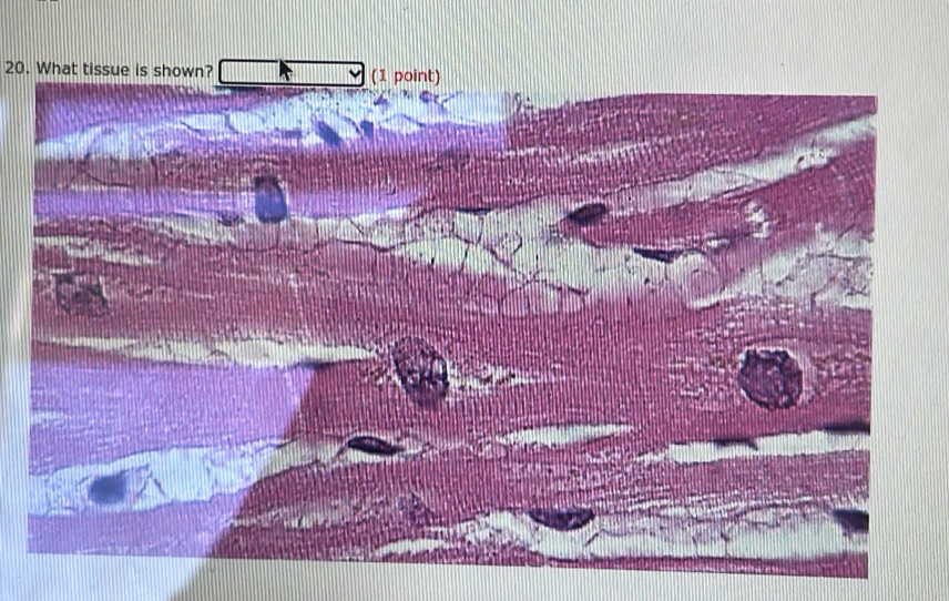 What tissue is shown?