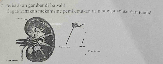 Perhatikan gambar di bawah! 
Bagaimanakah mekanisme pembentukan urin hingga keluar dari tubuh!