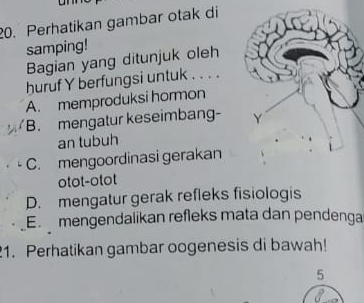 Perhatikan gambar otak di
samping!
Bagian yang ditunjuk oleh
huruf Y berfungsi untuk . . . .
A. memproduksi hormon
B. mengatur keseimbang- 
an tubuh
C. mengoordinasi gerakan
otot-otot
D. mengatur gerak refleks fisiologis
E mengendalikan refleks mata dan pendenga
1. Perhatikan gambar oogenesis di bawah!
5