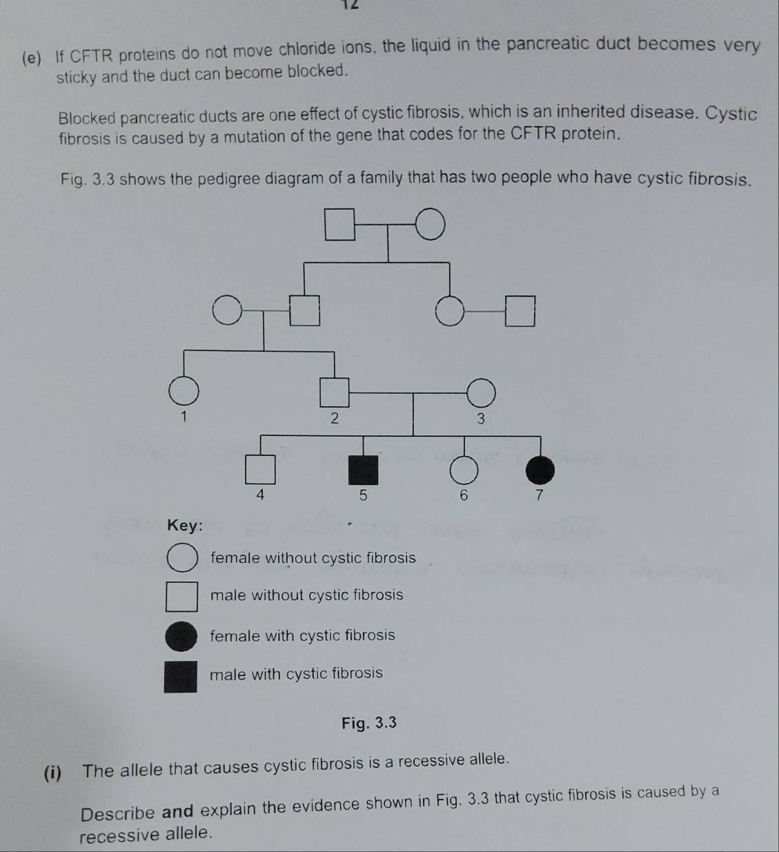 12
(e) If CFTR proteins do not move chloride ions, the liquid in the pancreatic duct becomes very
sticky and the duct can become blocked.
Blocked pancreatic ducts are one effect of cystic fibrosis, which is an inherited disease. Cystic
fibrosis is caused by a mutation of the gene that codes for the CFTR protein.
Fig. 3.3 shows the pedigree diagram of a family that has two people who have cystic fibrosis.
Key:
female without cystic fibrosis
male without cystic fibrosis
female with cystic fibrosis
male with cystic fibrosis
Fig. 3.3
(i) The allele that causes cystic fibrosis is a recessive allele.
Describe and explain the evidence shown in Fig. 3.3 that cystic fibrosis is caused by a
recessive allele.
