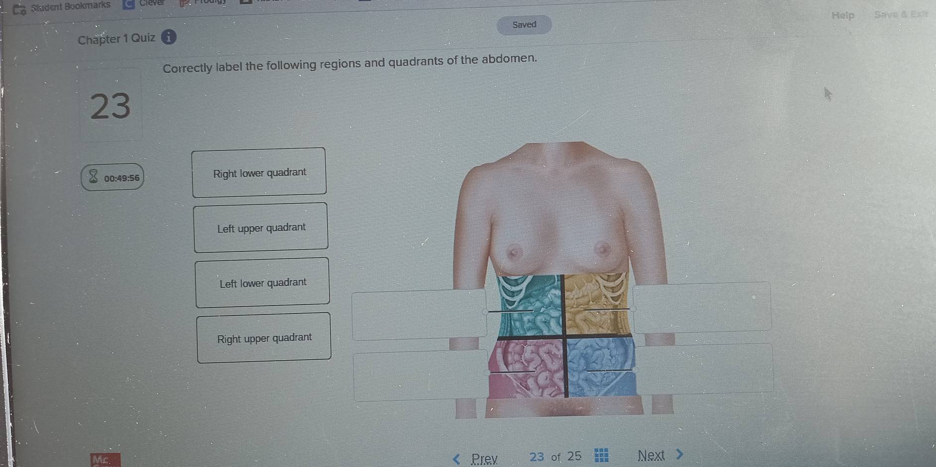 Student Bookmarks
Help Save & Exit
Chapter 1 Quiz Saved
Correctly label the following regions and quadrants of the abdomen.
23
a 00:49:56 Right lower quadrant
Left upper quadrant
Left lower quadrant
Right upper quadrant
Prev 23 of 25 Next >