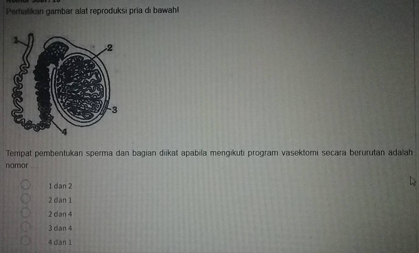 Perhatikan gambar alat reproduksi pria di bawah!
Tempat pembentukan sperma dan bagian diikat apabila mengikuti program vasektomi secara berurutan adalah
nomor
1 dan 2
2 dan 1
2 dan 4
3 dan 4
4 dan 1