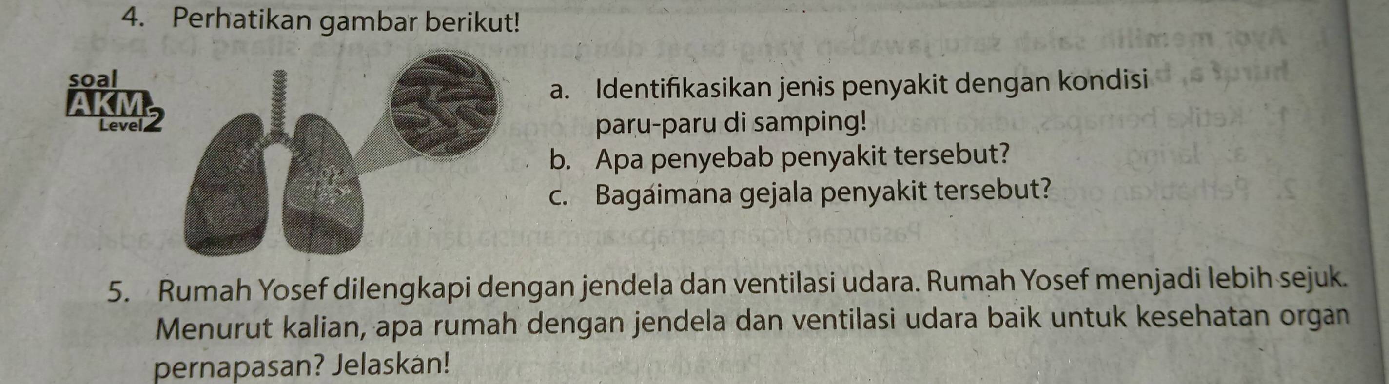 Perhatikan gambar berikut! 
soal 
a. Identifikasikan jenis penyakit dengan kondisi 
Level 2paru-paru di samping! 
b. Apa penyebab penyakit tersebut? 
c. Bagaimana gejala penyakit tersebut? 
5. Rumah Yosef dilengkapi dengan jendela dan ventilasi udara. Rumah Yosef menjadi lebih sejuk. 
Menurut kalian, apa rumah dengan jendela dan ventilasi udara baik untuk kesehatan organ 
pernapasan? Jelaskan!