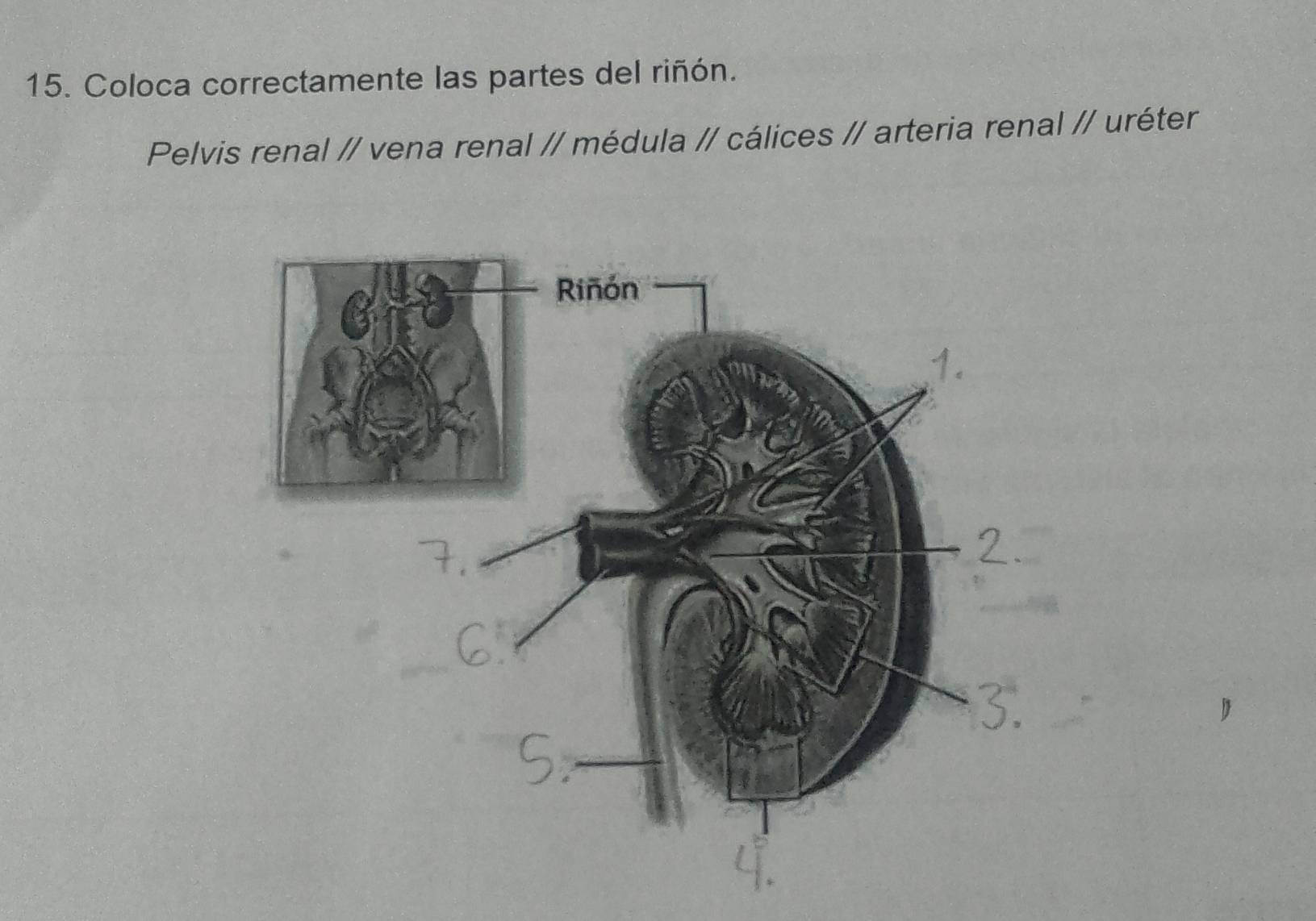 Resuelto:Coloca correctamente las partes del riñón. Pelvis renal ...