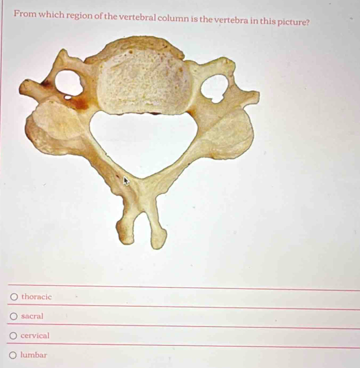 From which region of the vertebral column is the vertebra in this picture?
thoracic
sacral
cervical
lumbar