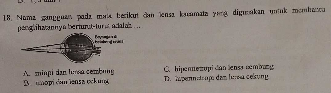 1 , .
18. Nama gangguan pada mata berikut dan lensa kacamata yang digunakan untuk membantu
penglihatannya berturut-turut adalah ...
A. miopi dan lensa cembung C. hipermetropi dan lensa cembung
B. miopi dan lensa cekung D. hipermetropi dan lensa cekung