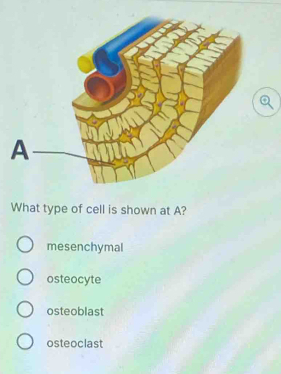 What type of cell is shown at A?
mesenchymal
osteocyte
osteoblast
osteoclast