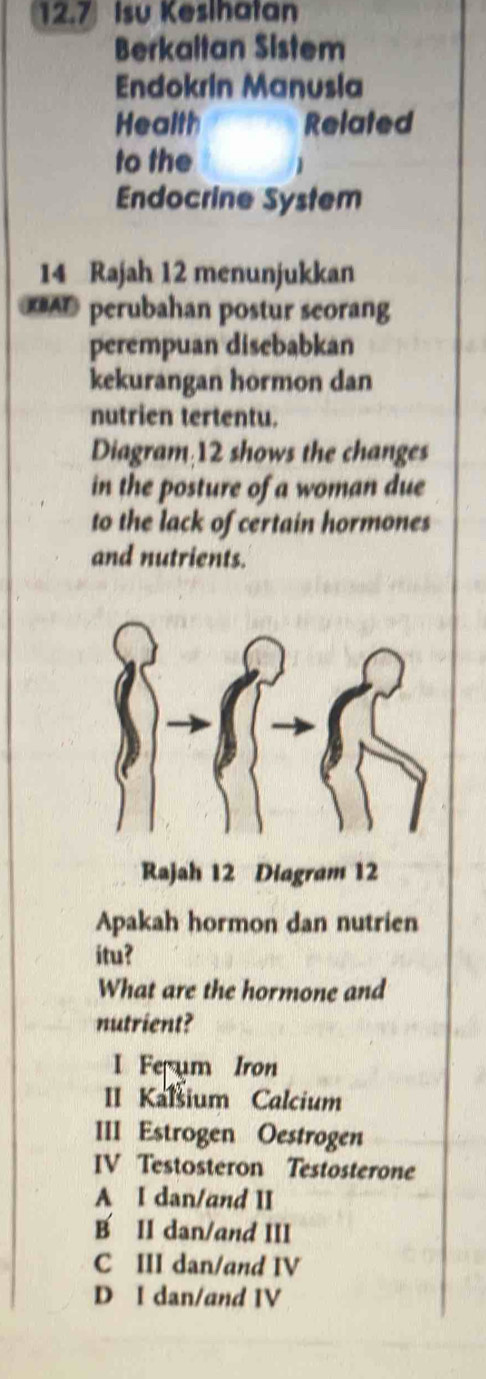 12.7 Isu Kesihatan
Berkaitan Sistem
Endokrin Manusia
Health Related
to the
Endocrine System
14 Rajah 12 menunjukkan
AD perubahan postur seorang
perempuan disebabkan
kekurangan hormon dan
nutrien tertentu.
Diagram 12 shows the changes
in the posture of a woman due
to the lack of certain hormones
and nutrients.
Rajah 12 Diagram 12
Apakah hormon dan nutrien
itu?
What are the hormone and
nutrient?
I Fe um Iron
II Kalsium Calcium
III Estrogen Oestrogen
IV Testosteron Testosterone
A I dan/and II
B II dan/and III
C III dan/and IV
D I dan/and IV