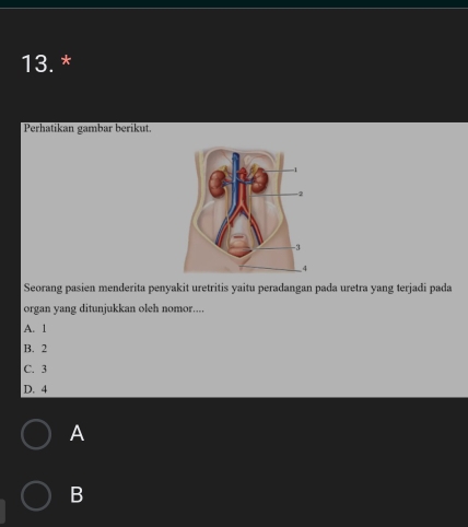 Perhatikan gambar berikut.
Seorang pasien menderita penyakit uretritis yaitu peradangan pada uretra yang terjadi pada
organ yang ditunjukkan oleh nomor....
A. 1
B. 2
C. 3
D. 4
A
B