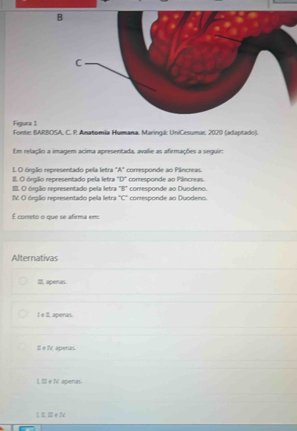 Fonte: BARBOSA, C. P. Anatomia Humana. Maringá: UniCesumar, 2020 (adaptado).
Em relação a imagem acima apresentada, avalie as afirmações a seguir:
L O órgão representado pela letra "A" corresponde ao Pâncreas.
I. O órgão representado pela letra "D" corresponde ao Pâncreas.
. O órgão representado pela letra ''B'' corresponde ao Duodeno.
IV. O órgão representado pela letra "C" corresponde ao Duodeno.
É correto o que se afirma em:
Alternativas
III, apenas.
I e I apenas.
I e IV, apenas.
I, II e IV, apenas.
LI■eN