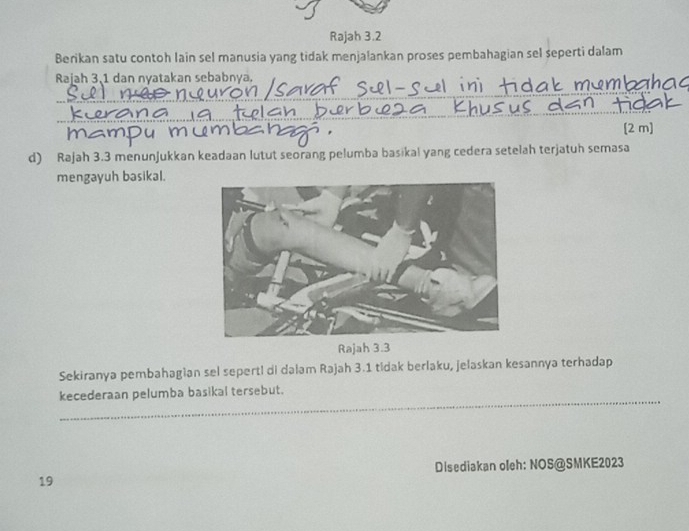 Rajah 3.2 
Berikan satu contoh lain sel manusia yang tidak menjalankan proses pembahagian sel seperti dalam 
Rajah 3, 1 dan nyatakan sebabnya. 

[2 m] 
d) Rajah 3.3 menunjukkan keadaan lutut seorang pelumba basikal yang cedera setelah terjatuh semasa 
mengayuh basikal. 
Rajah 3.3 
Sekiranya pembahagian sel seperti di dalam Rajah 3.1 tidak berlaku, jelaskan kesannya terhadap 
_ 
kecederaan pelumba basikal tersebut. 
Disediakan oleh: NOS@SMKE2023 
19