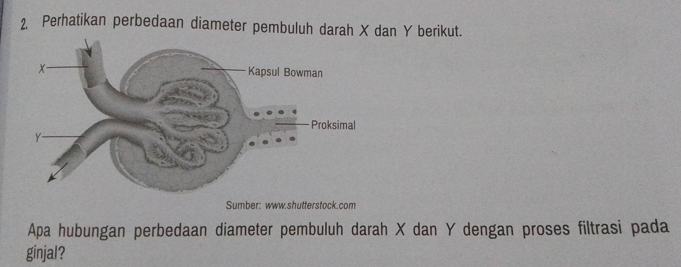 Perhatikan perbedaan diameter pembuluh darah X dan Y berikut. 
Sumber: www.shutterstock.com 
Apa hubungan perbedaan diameter pembuluh darah X dan Y dengan proses filtrasi pada 
ginjal?