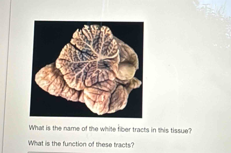 What is the name of the white fiber tracts in this tissue? 
What is the function of these tracts?