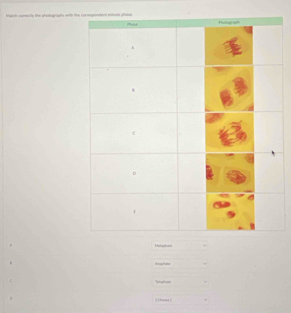 Match correctly the photographs with the
Metaphase
Anaphase
Telophase
| Choose ]