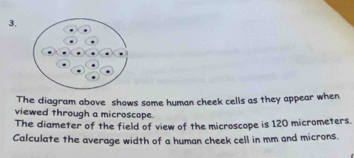 3, 
The diagram above shows some human cheek cells as they appear when 
viewed through a microscope. 
The diameter of the field of view of the microscope is 120 micrometers. 
Calculate the average width of a human cheek cell in mm and microns.