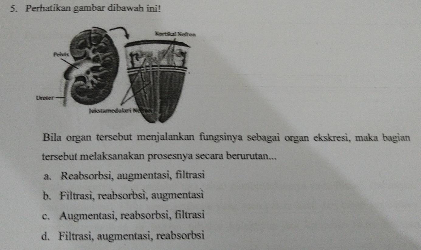 Perhatikan gambar dibawah ini!
Bila organ tersebut menjalankan fungsinya sebagai organ ekskresi, maka bagian
tersebut melaksanakan prosesnya secara berurutan...
a. Reabsorbsi, augmentasi, filtrasi
b. Filtrasi, reabsorbsi, augmentasi
c. Augmentasi, reabsorbsi, filtrasi
d. Filtrasi, augmentasi, reabsorbsi