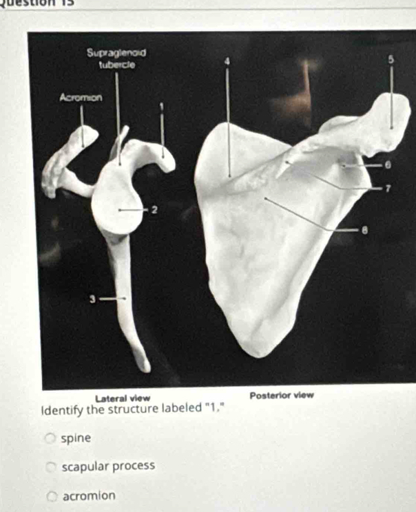 Identify the structure labeled "1."
spine
scapular process
acromion