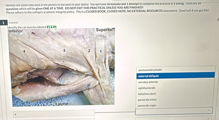 identify the items indicated in the photos to the best of your ability. You will have 30 minutes and 1 attempt to complete this practical in 1 sitting. I here are 24
questions which will be given ONE AT A TIME. DO NOT EXIT THIS PRACTICAL UNLESS YOU ARE FINISHED!
Please adhere to the college's academic integrity policy. This is a CLOSED BOOK, CLOSED NOTE, NO EXTERNAL RESOURCES assessment. Good luck & you got this!
1 4 points
pectoantebrachialis
external obliques
serratus anterior
xiphihumeralis
latissimus dorsi
pectoralis minor
pectoralis major
4