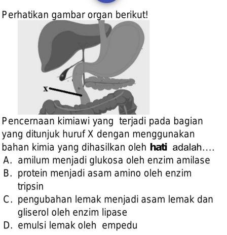 Perhatikan gambar organ berikut!
Pencernaan kimiawi yang terjadi pada bagian
yang ditunjuk huruf X dengan menggunakan
bahan kimia yang dihasilkan oleh hati adalah....
A. amilum menjadi glukosa oleh enzim amilase
B. protein menjadi asam amino oleh enzim
tripsin
C. pengubahan lemak menjadi asam lemak dan
gliserol oleh enzim lipase
D. emulsi lemak oleh empedu