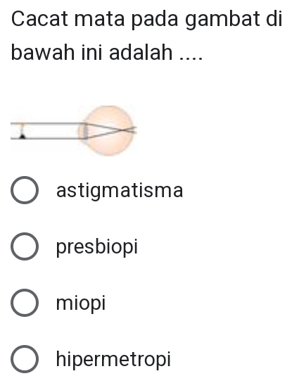 Cacat mata pada gambat di
bawah ini adalah ....
astigmatisma
presbiopi
miopi
hipermetropi