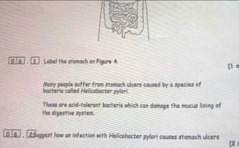 6 1 Label the stomach on Figure 4, 
[1 m 
Many people suffer from stomach ulcers caused by a species of 
bacteria called Helicobacter pylori. 
These are acid-tolerant bacteria which can damage the mucus lining of 
the digestive system. 
016] .[2Suggest how an infection with Helicobacter pylori causes stomach ulcers 
[2