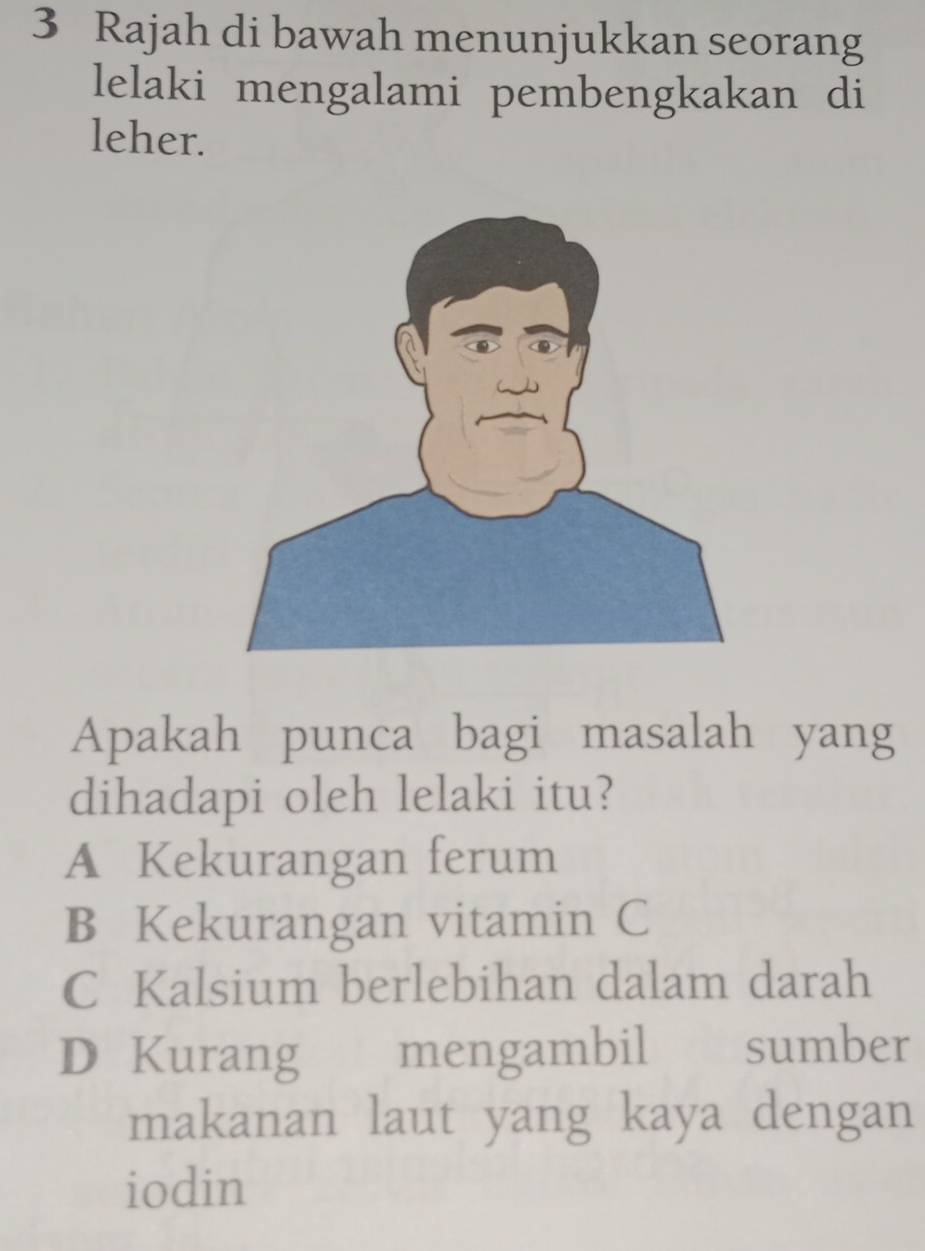 Rajah di bawah menunjukkan seorang
lelaki mengalami pembengkakan di
leher.
Apakah punca bagi masalah yang
dihadapi oleh lelaki itu?
A Kekurangan ferum
B Kekurangan vitamin C
C Kalsium berlebihan dalam darah
D Kurang mengambil sumber
makanan laut yang kaya dengan
iodin