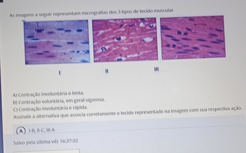 As imagens a seguir representam micrografías dos 3 tipos de tecido muscular.
'
A) Contração involuntária e lenta.
B) Contração voluntária, em geral vigorosa.
C) Contração involuntária e rápida.
Assinale a alternativa que associa corretamente o tecido representado na imagem com sua respectiva ação.
A Ⅰ-B, II-C, III-A
Salvo pela última véz 16:37:32