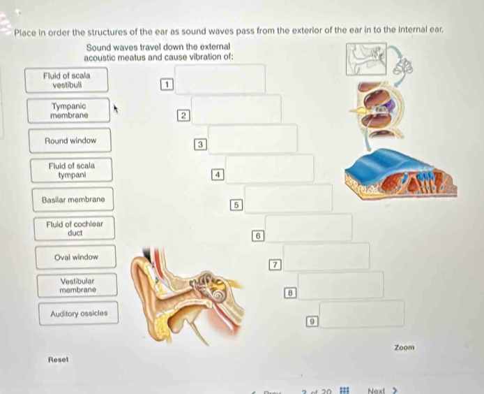Solved: Place in order the structures of the ear as sound waves pass ...