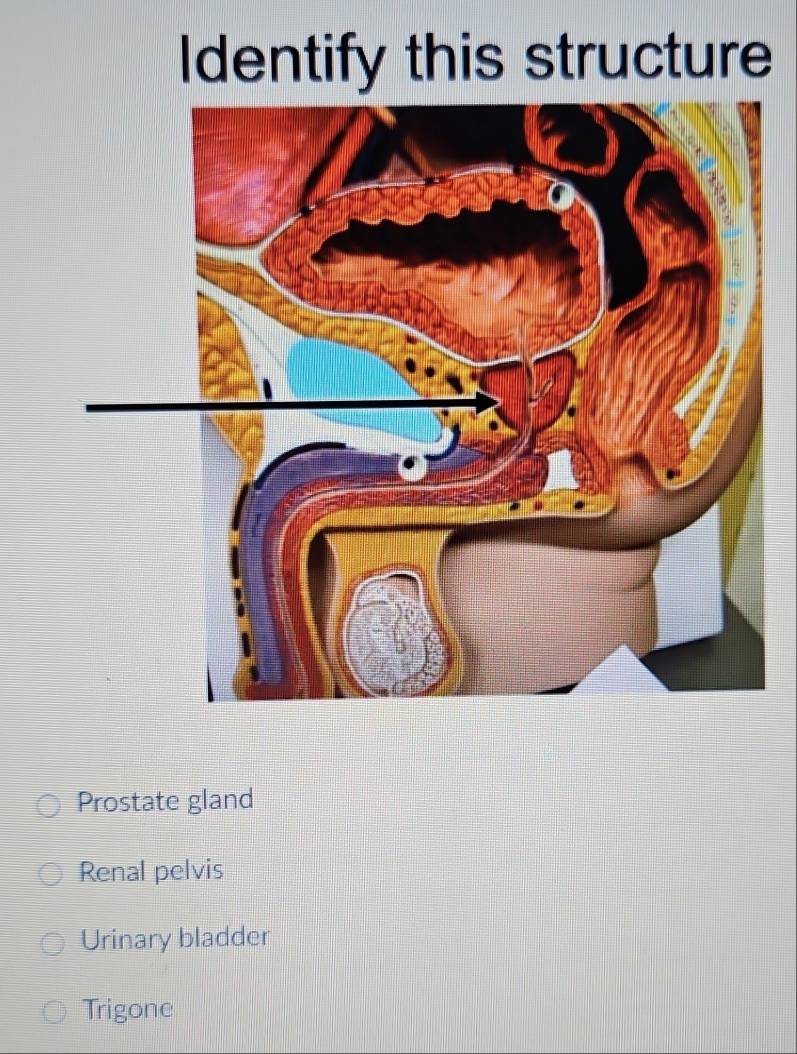 Solved: Identify this structure Prostate gland Renal pelvis Urinary ...