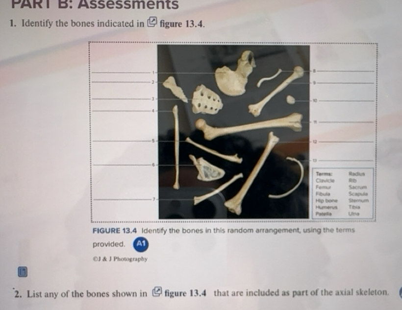 Solved: Assessments 1. Identify the bones indicated in & figure 13.4 ...