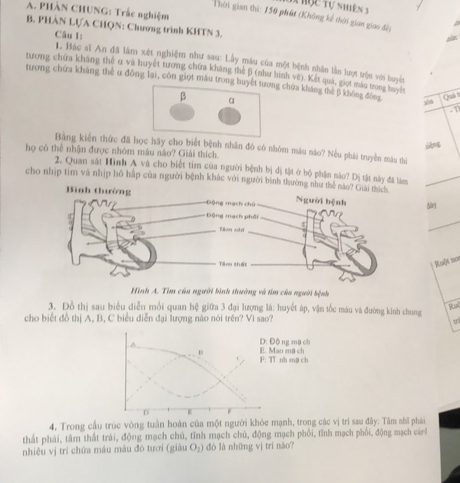 A Hục tự nhiên 3
A. PHÀN CHUNG: Trắc nghiệm
Thời gian thi: 150 phút (Không kế thời gian giao đề)
B. PHÂN LỤA CHQN: Chương trình KHTN 3.
Câu 1:
L. Bác sĩ An đã làm xét nghiệm như sau: Lây máu của một bệnh nhân lần lượt trộn với huyệt
tương chứa kháng thế α và huyệt tương chứa kháng thể β (như hình vệ). Kết quả, giọt mâu trong huyệt
tương chứa kháng thể α đông lại, côn giọt máu trong huyết tương chứa kháng thể β không đông Quả t
β α
sha
. 1
Bằng kiến thức đã học hãy cho biết bệnh nhân đó có nhóm máu náo? Nếu phái truyền máu thì
họ có thể nhận được nhóm máu nào? Giải thích.
2. Quan sát Hình A và cho biết tim của người bệnh bị đị tật ở bộ phận nào? Dị tật này đã làm
cho nhịp tim và nhịp hồ hập của người bệnh khác với người bình thường như thể nào? Giải thích
day
Ruột not
Hình A. Tìm của người bình thường và tìm của người bệnh
3. Đồ thị sau biểu diễn mối quan hệ giữa 3 đại lượng là: huyết áp, vận tốc máu và đường kính chung
Rui
cho biết đồ thị A, B, C biểu diễn đại lượng nào nói trên? Vì sao? un
D: Độ ng mạ ch
μ E. Mao mạ ch
F: TT nh mạ ch
D E
4. Trong cầu trúc vòng tuần hoàn của một người khỏe mạnh, trong các vị trí sau đãy: Tâm nhĩ phái
thất phải, tâm thất trái, động mạch chủ, tĩnh mạch chủ, động mạch phổi, tĩnh mạch phổi, động mạch cánh
nhiêu vj trí chứa máu màu đó tươi (giàu O_2) đó là những vị trí nào?