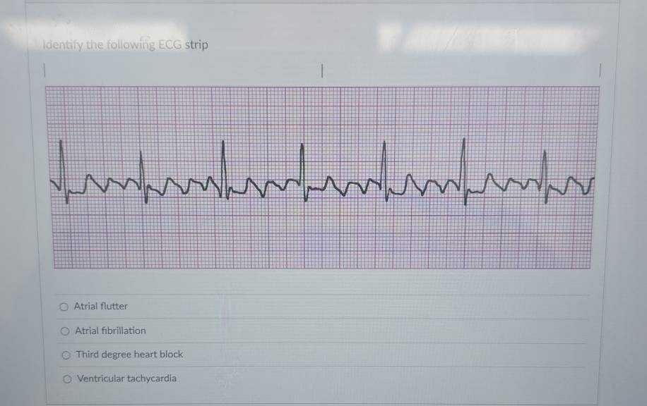 Solved: Identify the following ECG strip Atrial flutter Atrial ...