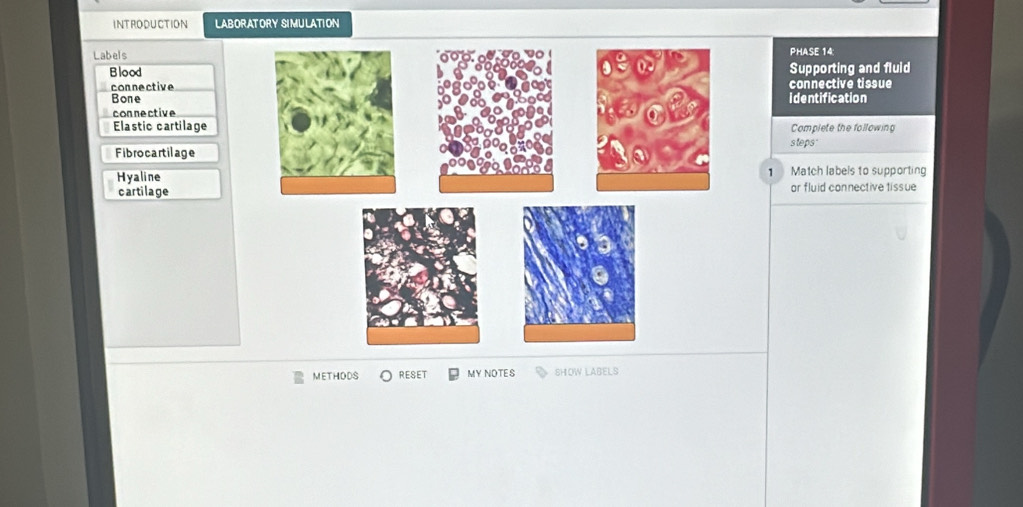 INTRODUCTION LABORATORY SIMULATION 
LabelsPHASE 14: 
BloodSupporting and fluld 
connectiveconnective tissue 
Boneidentification 
connective 
Elastic cartilageComplete the following 
Fibrocartilagesteps: 
Hyaline1 Match labels to supporting 
cartilageor fluid connective tissue 
METHODS RESET MY NOTES SHOW LABELS