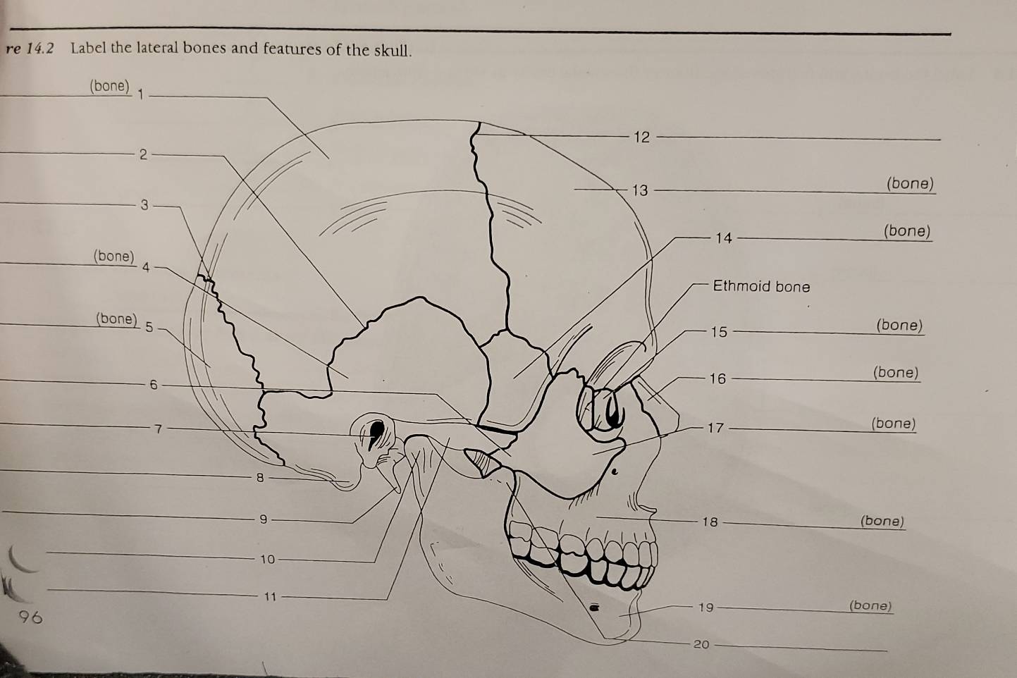 re 14.2 Label the lateral bones and features of the skull. 
_ 
_ 
_ 
_7 
_ 
9