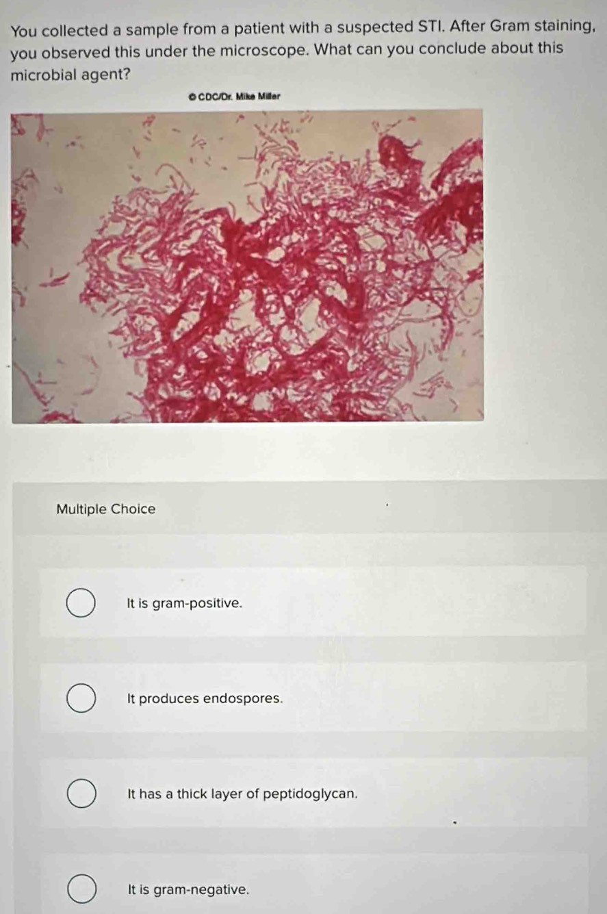 You collected a sample from a patient with a suspected STI. After Gram staining,
you observed this under the microscope. What can you conclude about this
microbial agent?
Multiple Choice
It is gram-positive.
It produces endospores.
It has a thick layer of peptidoglycan.
It is gram-negative.