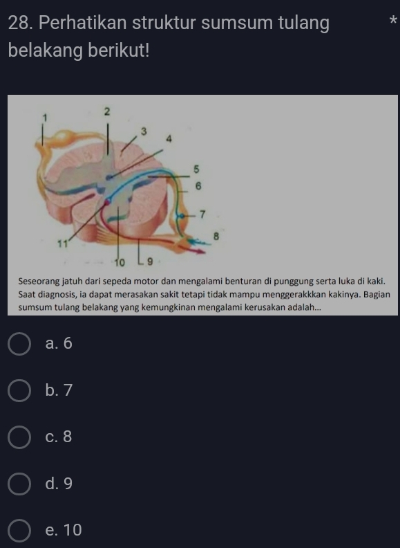 Perhatikan struktur sumsum tulang
belakang berikut!
Seseorang jatuh dari sepeda motor dan mengalami benturan di punggung serta luka di kaki.
Saat diagnosis, ia dapat merasakan sakit tetapi tidak mampu menggerakkkan kakinya. Bagian
sumsum tulang belakang yang kemungkinan mengalami kerusakan adalah...
a. 6
b. 7
c. 8
d. 9
e. 10