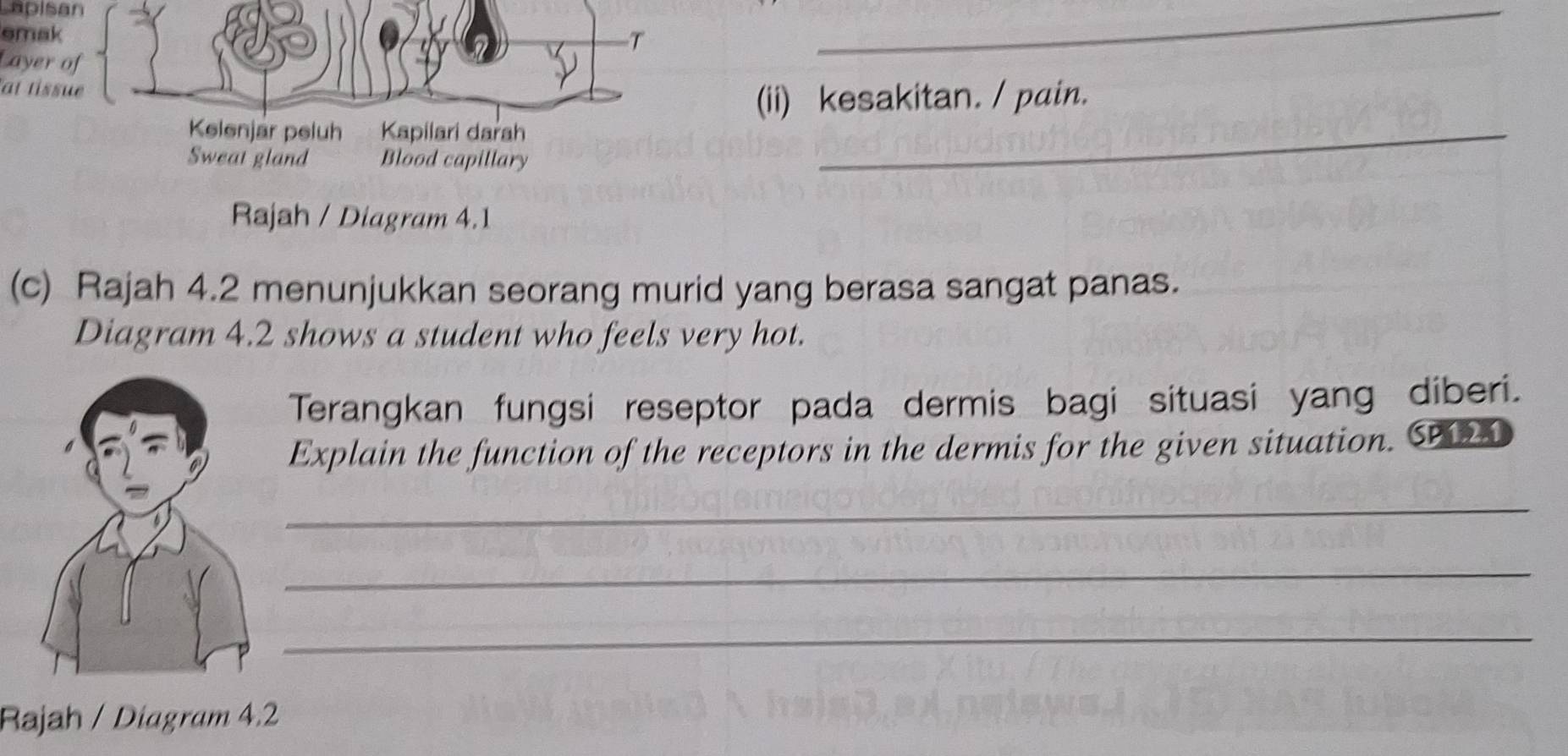 Selesai:Lapisan emak T Layer of _ at tissue (ii) kesakitan. / pain ...