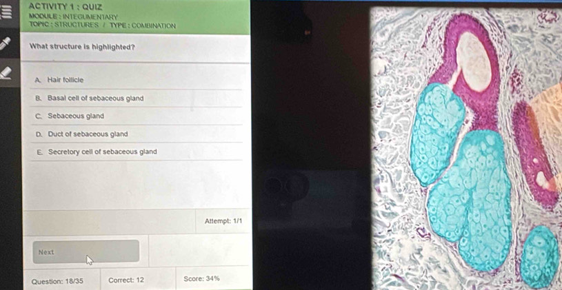 ACTIVITY 1 : QUIZ
MODULE : INTEGUMENTARY
TOPIC : STRUCTURES / TYPE : COMBINATION
What structure is highlighted?
A. Hair follicle
B. Basal cell of sebaceous gland
C. Sebaceous gland
D. Duct of sebaceous gland
E. Secretory cell of sebaceous gland
Attempt: 1/1
Next
Question: 18/35 Correct: 12 Score: 34%