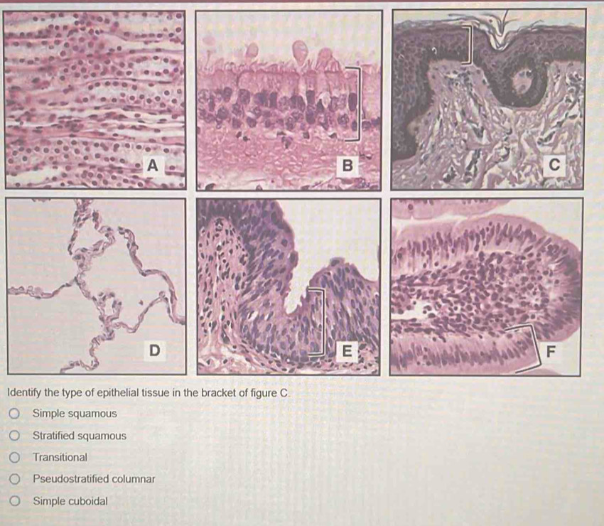 Solved: Identify the type of epithelial tissue in the bracket of figure ...