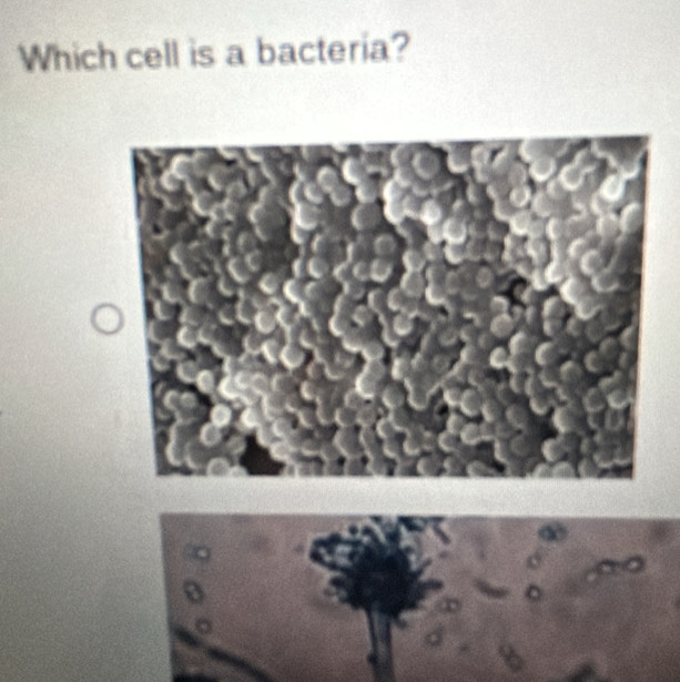 Which cell is a bacteria?