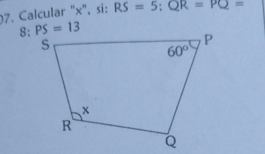 )7. Calcular "×", si: RS=5;QR=PQ=