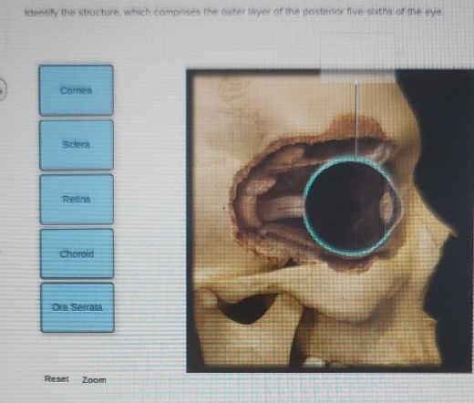 Solved: identify the structure, which comprises the outer layer of the ...