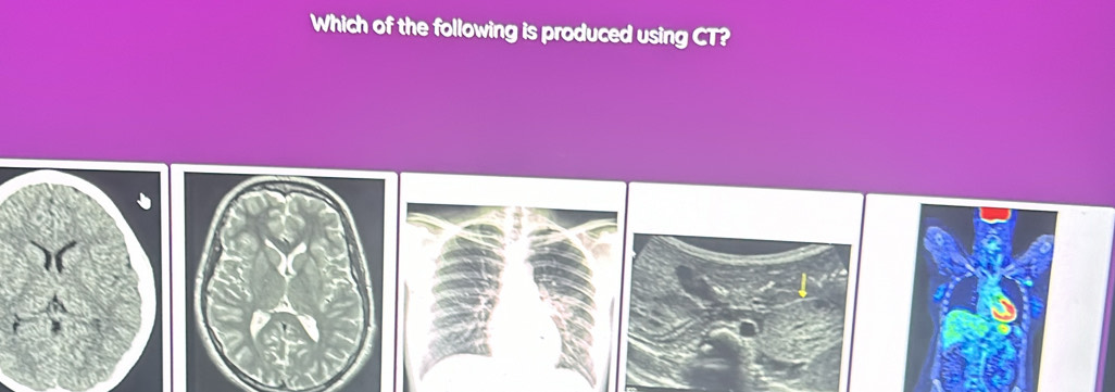 Which of the following is produced using CT?